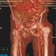 Illustration for article titled Brilliance CT 256-Slice Scanner from Philips Gets to the Heart of the Problem